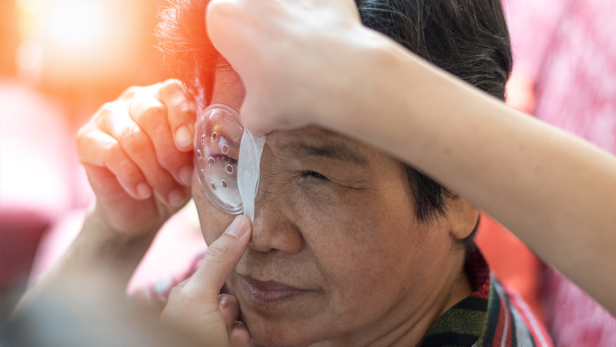 A woman recovering from laser cataract surgery